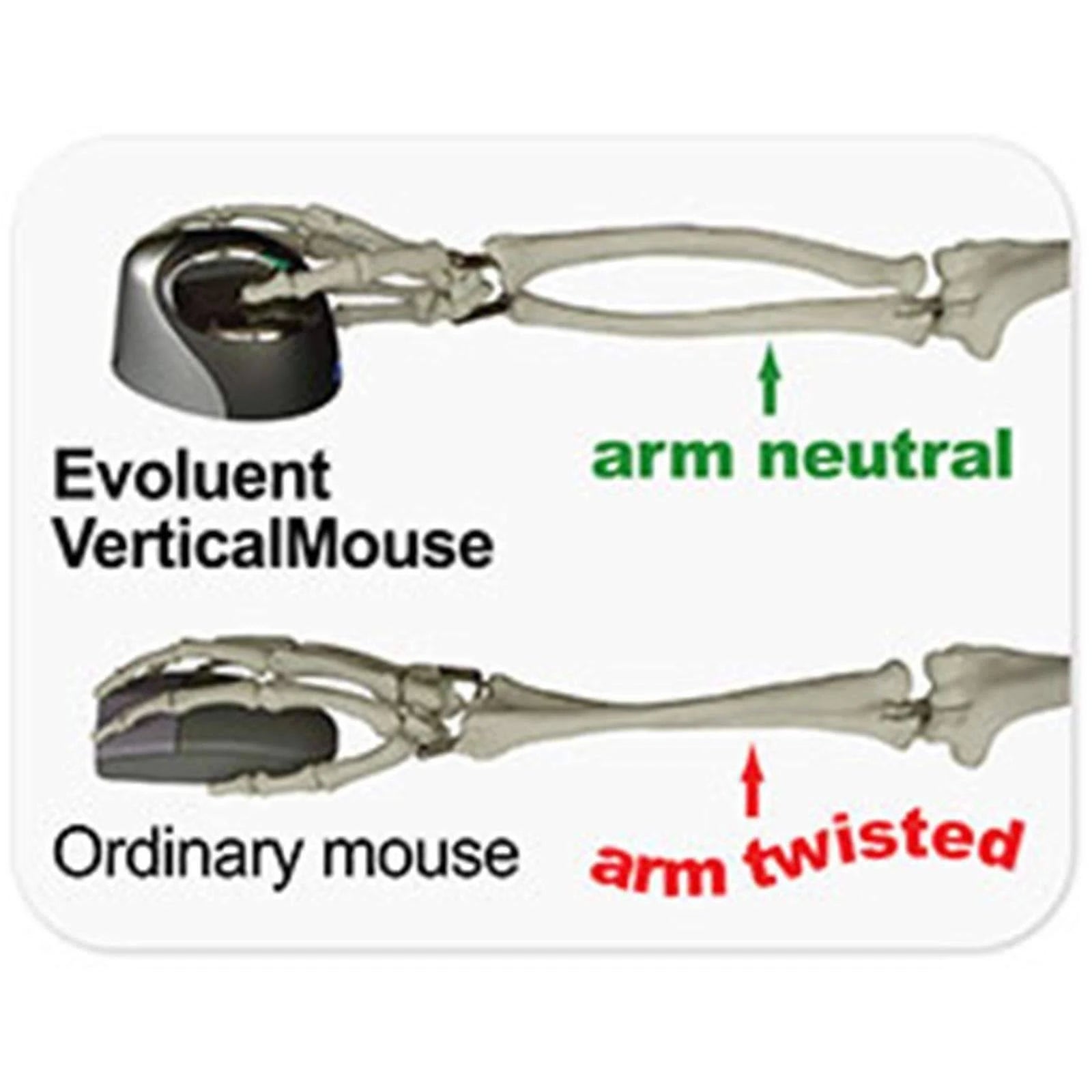 Vertical Mouse Right Mouse k7m
