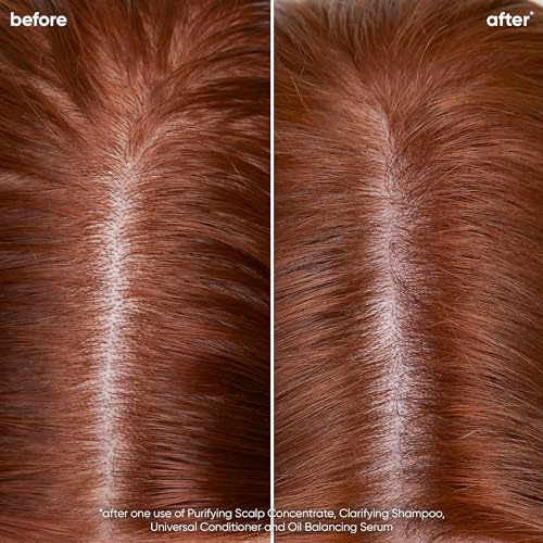 Biolage Scalp Sync Clarifying Shampoo & Conditioner Set, Paraben & Silicone Free H30092